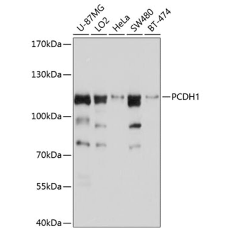 Western Blot - Anti-PCDH1 Antibody (A11270) - Antibodies.com