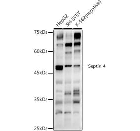 Western Blot - Anti-SEPT4 Antibody (A11271) - Antibodies.com