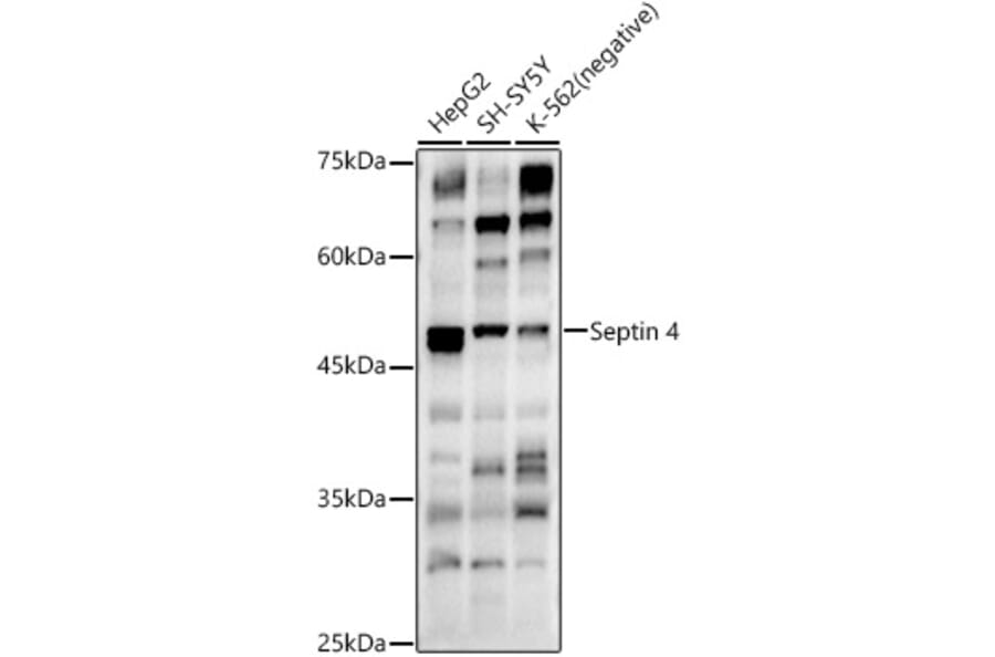 Western Blot - Anti-SEPT4 Antibody (A11271) - Antibodies.com