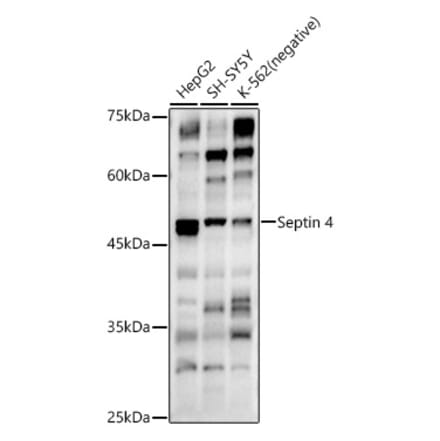 Western Blot - Anti-SEPT4 Antibody (A11271) - Antibodies.com