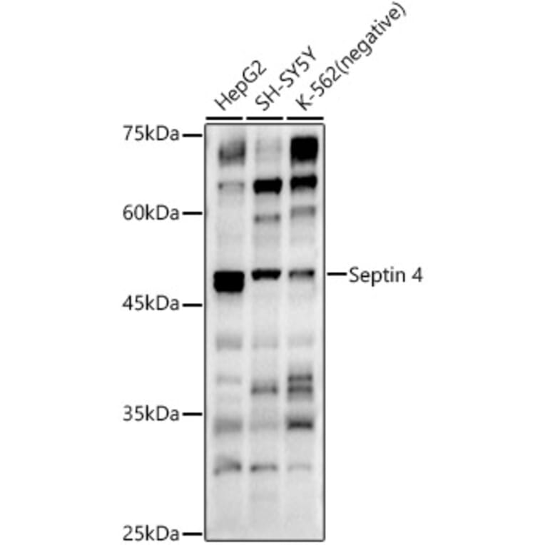 Western Blot - Anti-SEPT4 Antibody (A11271) - Antibodies.com