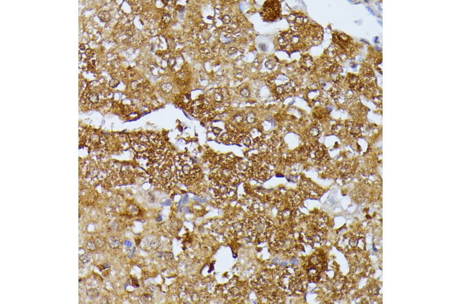 Immunohistochemistry - Anti-SEPT4 Antibody (A11271) - Antibodies.com
