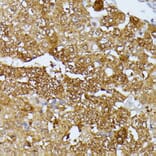 Immunohistochemistry - Anti-SEPT4 Antibody (A11271) - Antibodies.com