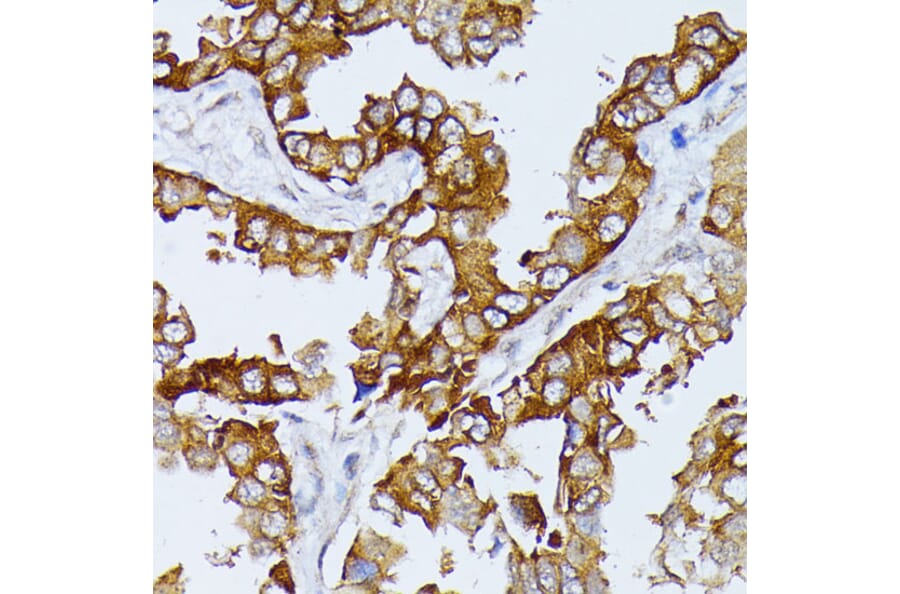 Immunohistochemistry - Anti-SEPT4 Antibody (A11271) - Antibodies.com