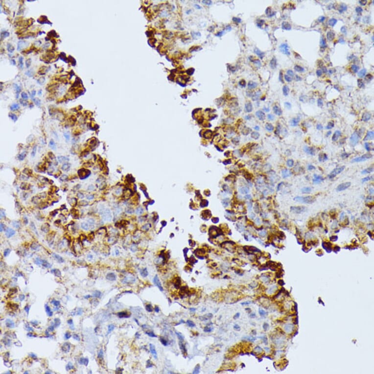 Immunohistochemistry - Anti-SEPT4 Antibody (A11271) - Antibodies.com