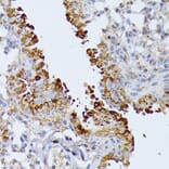 Immunohistochemistry - Anti-SEPT4 Antibody (A11271) - Antibodies.com