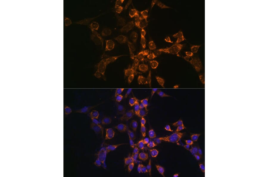 Immunofluorescence - Anti-SEPT4 Antibody (A11271) - Antibodies.com