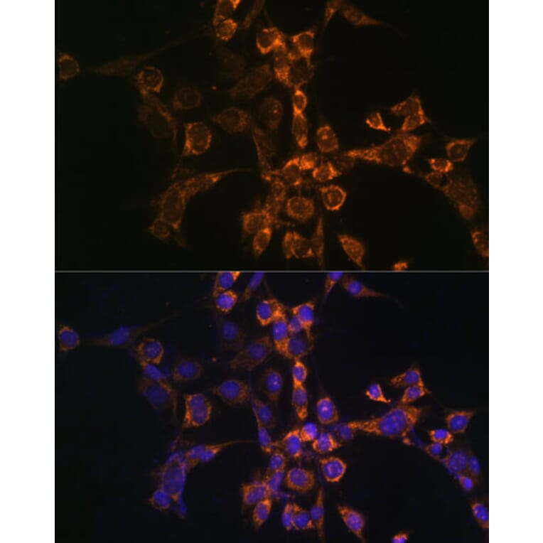 Immunofluorescence - Anti-SEPT4 Antibody (A11271) - Antibodies.com