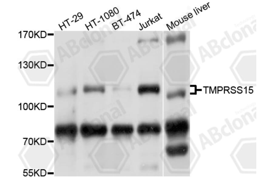 Western Blot - Anti-TMPRSS15 Antibody (A10239) - Antibodies.com