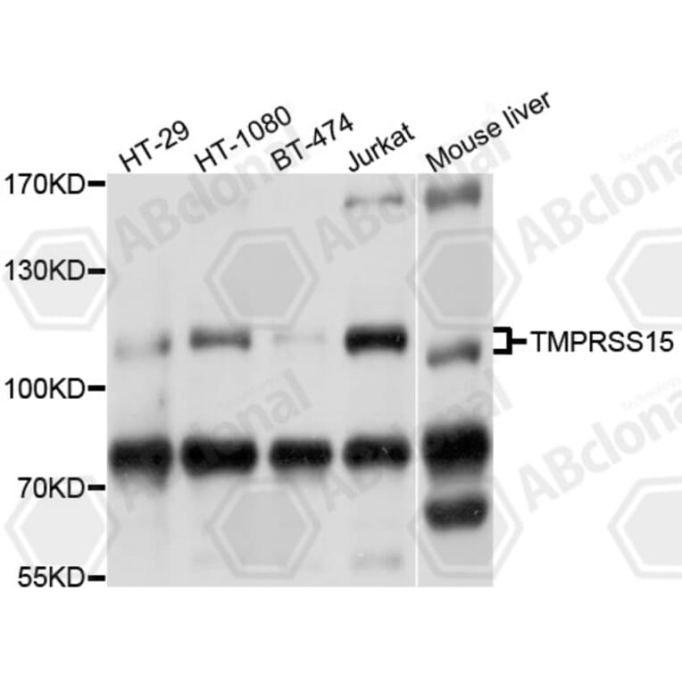 Western Blot - Anti-TMPRSS15 Antibody (A10239) - Antibodies.com