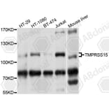 Western Blot - Anti-TMPRSS15 Antibody (A10239) - Antibodies.com