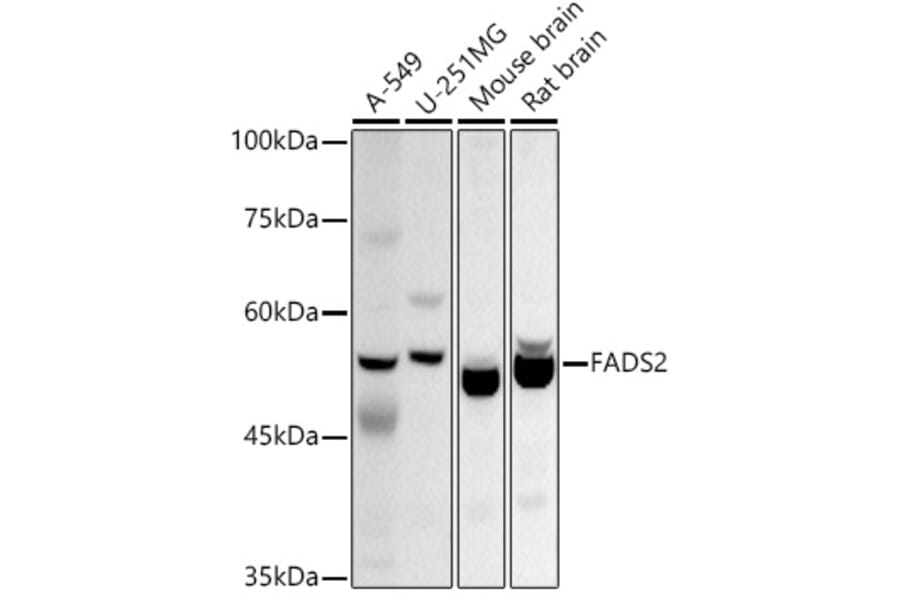 Western Blot - Anti-FADS2 Antibody (A11273) - Antibodies.com