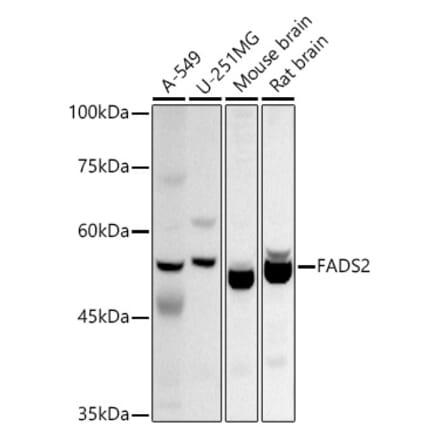 Western Blot - Anti-FADS2 Antibody (A11273) - Antibodies.com