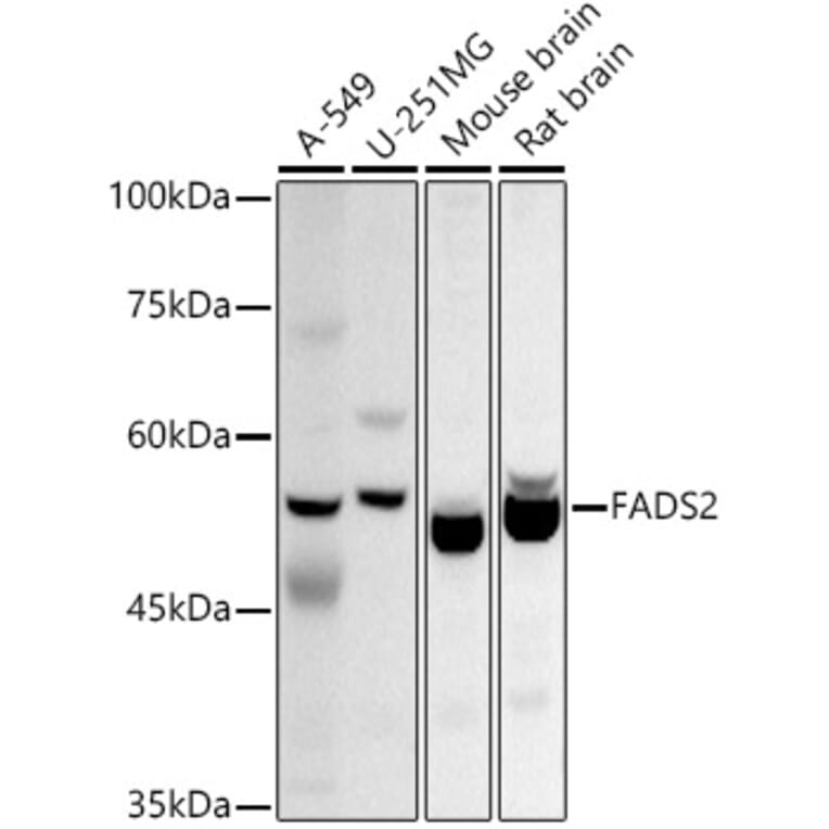 Western Blot - Anti-FADS2 Antibody (A11273) - Antibodies.com