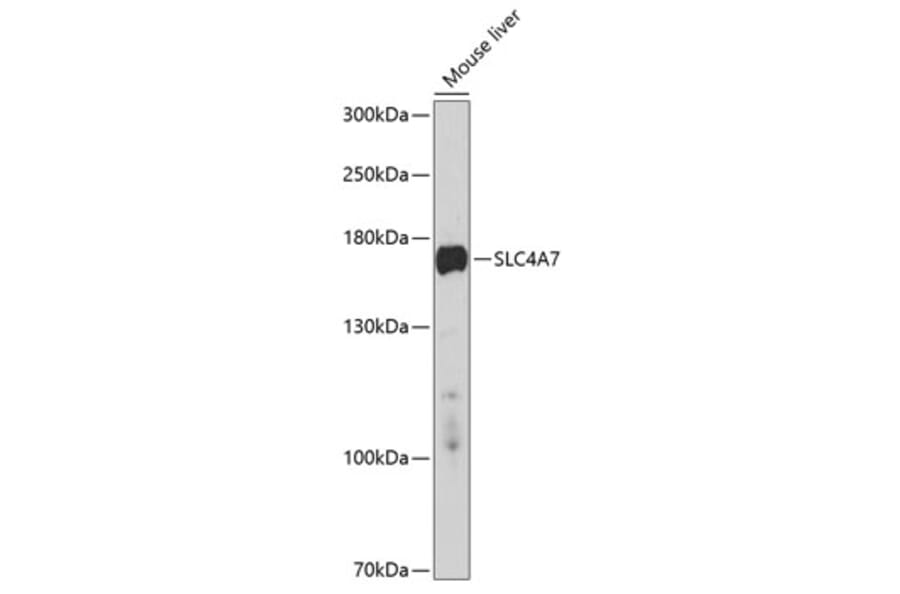 Western Blot - Anti-SLC4A7/NBCn1 Antibody (A11274) - Antibodies.com
