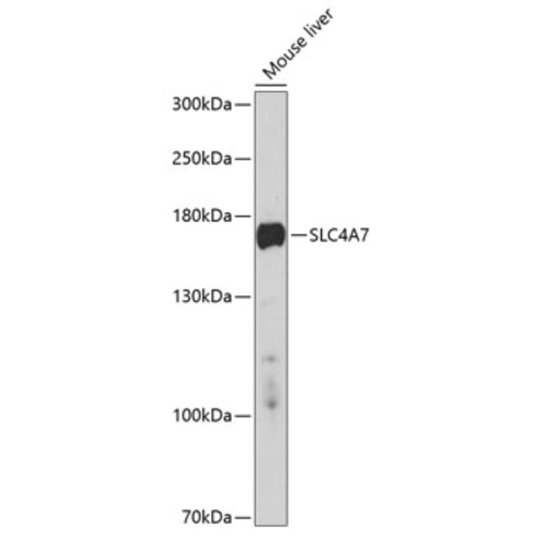 Western Blot - Anti-SLC4A7/NBCn1 Antibody (A11274) - Antibodies.com