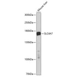 Western Blot - Anti-SLC4A7/NBCn1 Antibody (A11274) - Antibodies.com