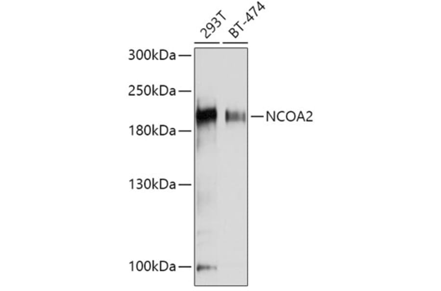 Western Blot - Anti-KAT13C/NCOA2 Antibody (A11275) - Antibodies.com