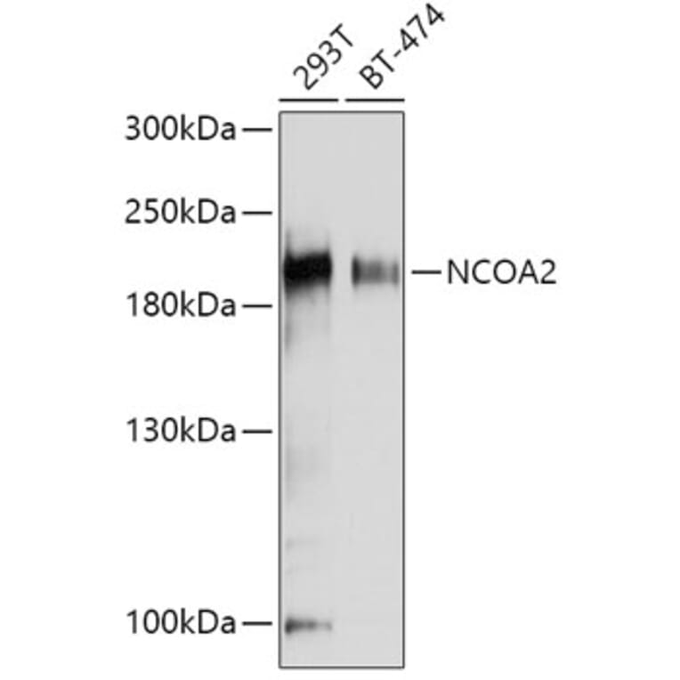 Western Blot - Anti-KAT13C / NCOA2 Antibody (A11275) - Antibodies.com