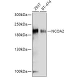 Western Blot - Anti-KAT13C / NCOA2 Antibody (A11275) - Antibodies.com