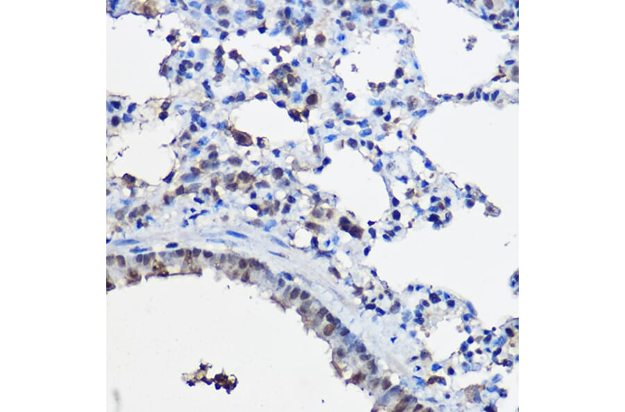 Immunohistochemistry - Anti-KAT13C/NCOA2 Antibody (A11275) - Antibodies.com