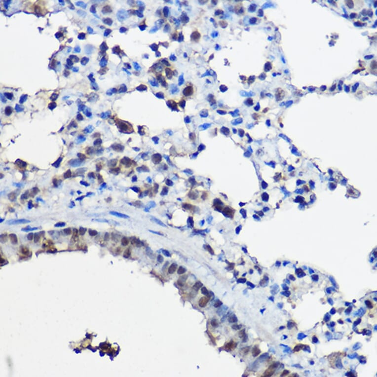 Immunohistochemistry - Anti-KAT13C / NCOA2 Antibody (A11275) - Antibodies.com