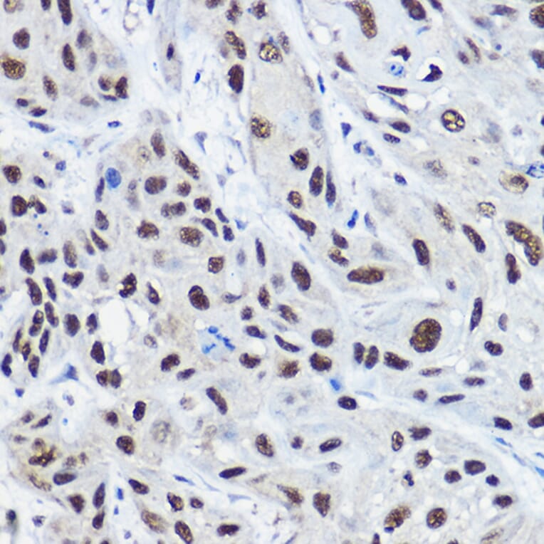 Immunohistochemistry - Anti-KAT13C / NCOA2 Antibody (A11275) - Antibodies.com