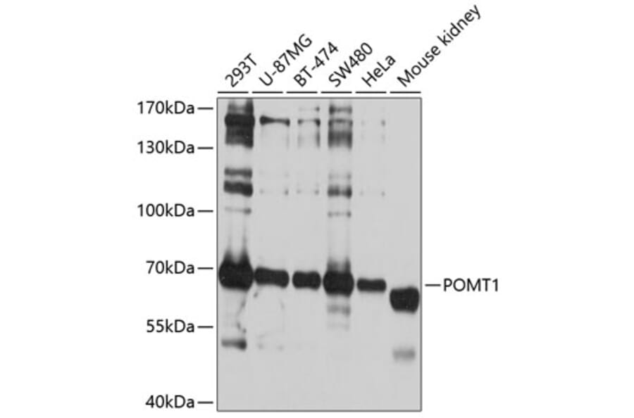 Western Blot - Anti-POMT1 Antibody (A11276) - Antibodies.com