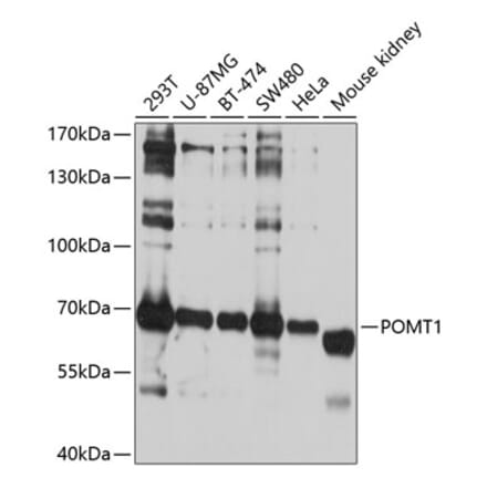 Western Blot - Anti-POMT1 Antibody (A11276) - Antibodies.com