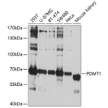 Western Blot - Anti-POMT1 Antibody (A11276) - Antibodies.com