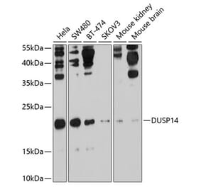 Western Blot - Anti-DUSP14 Antibody (A11277) - Antibodies.com