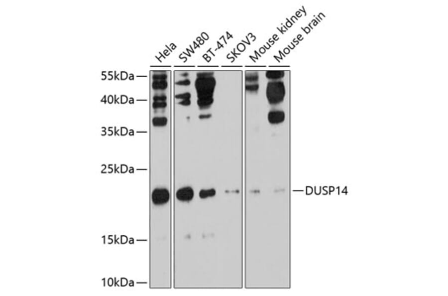 Western Blot - Anti-DUSP14 Antibody (A11277) - Antibodies.com