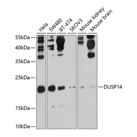 Western Blot - Anti-DUSP14 Antibody (A11277) - Antibodies.com