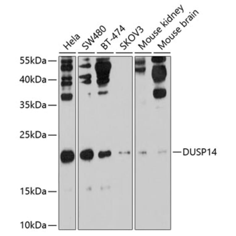 Western Blot - Anti-DUSP14 Antibody (A11277) - Antibodies.com
