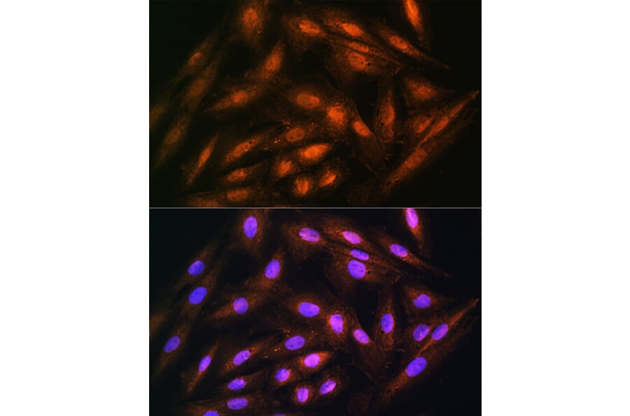 Immunofluorescence - Anti-DUSP14 Antibody (A11277) - Antibodies.com
