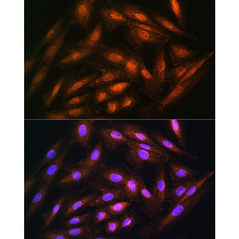 Immunofluorescence - Anti-DUSP14 Antibody (A11277) - Antibodies.com