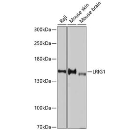 Western Blot - Anti-LRIG1 Antibody (A11278) - Antibodies.com