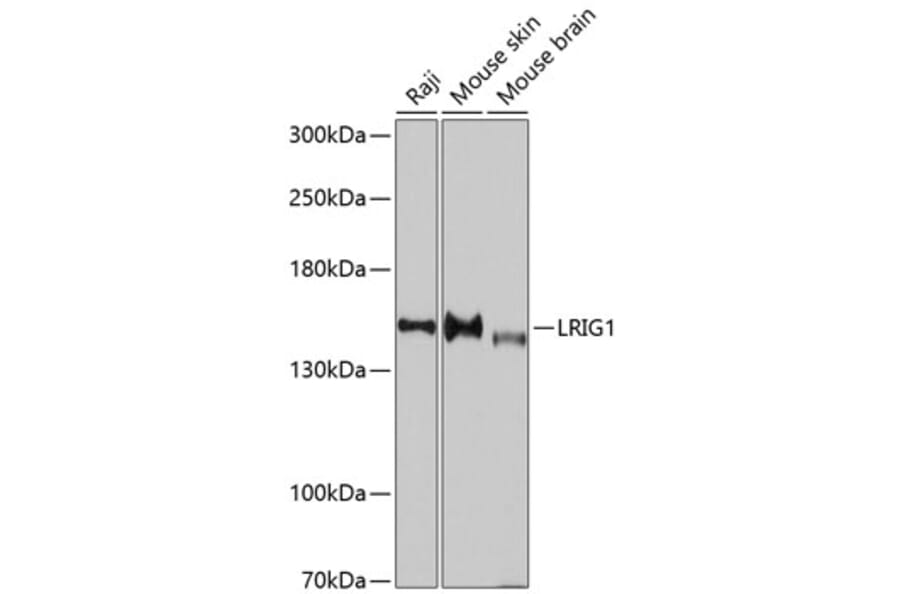 Western Blot - Anti-LRIG1 Antibody (A11278) - Antibodies.com