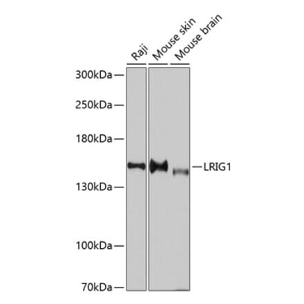 Western Blot - Anti-LRIG1 Antibody (A11278) - Antibodies.com