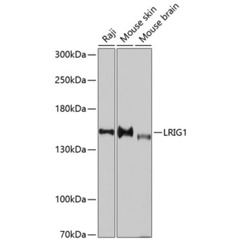 Western Blot - Anti-LRIG1 Antibody (A11278) - Antibodies.com