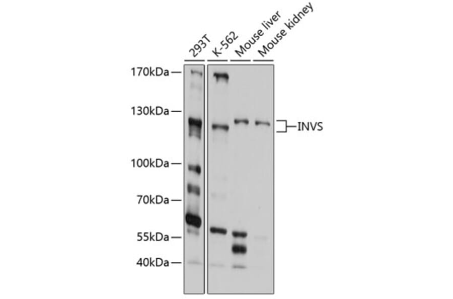 Western Blot - Anti-Inversin Antibody (A11279) - Antibodies.com