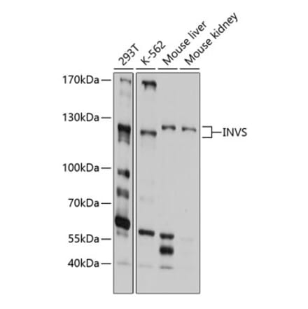 Western Blot - Anti-Inversin Antibody (A11279) - Antibodies.com