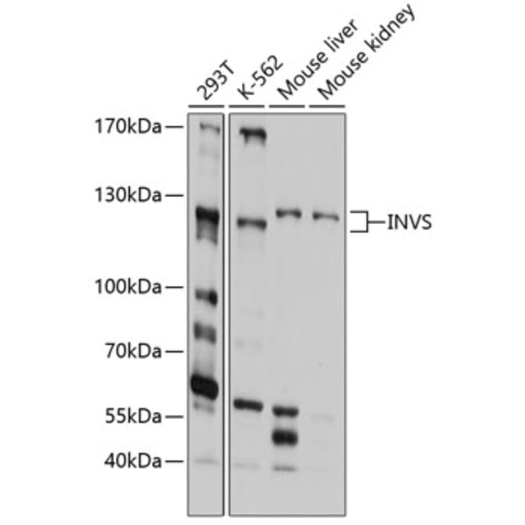 Western Blot - Anti-Inversin Antibody (A11279) - Antibodies.com