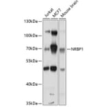Western Blot - Anti-MADM Antibody (A11280) - Antibodies.com