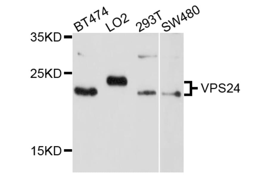 Western Blot - Anti-VPS24 Antibody (A10306) - Antibodies.com