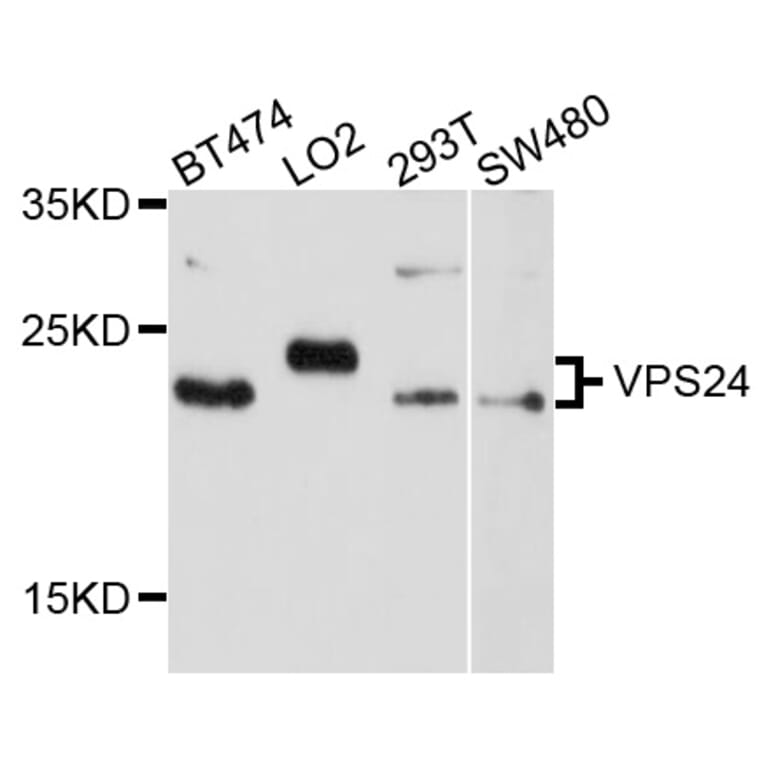 Western Blot - Anti-VPS24 Antibody (A10306) - Antibodies.com