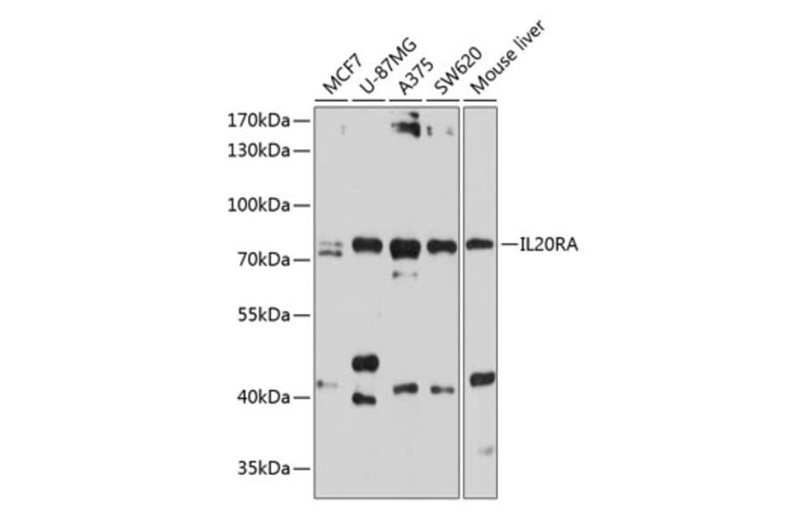 Western Blot - Anti-IL-20R1 Antibody (A11282) - Antibodies.com