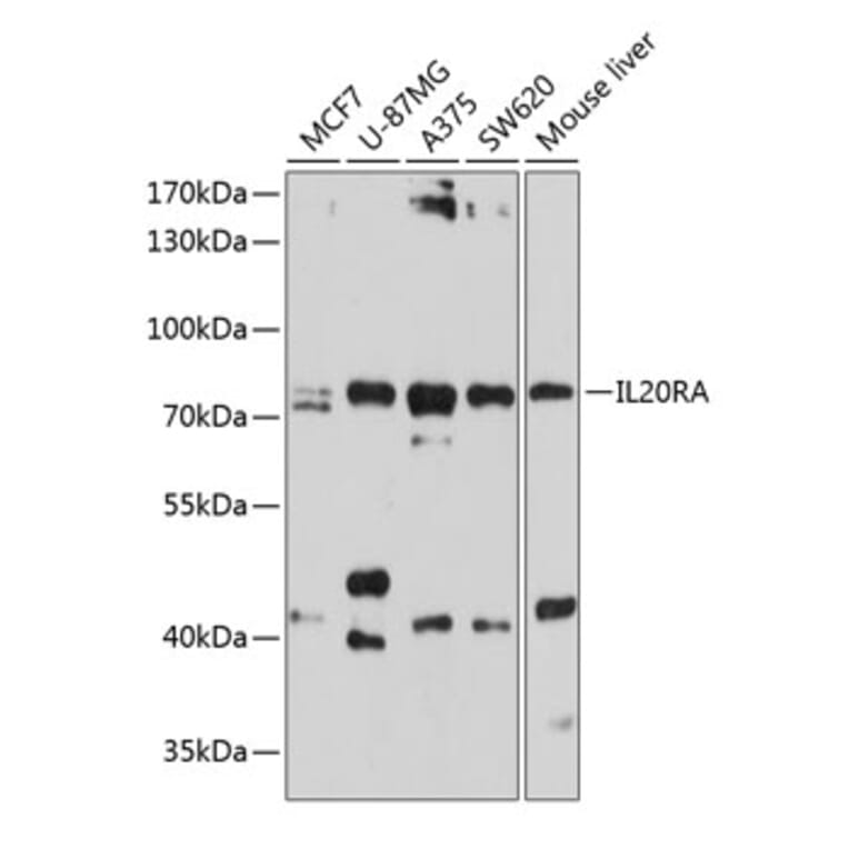 Western Blot - Anti-IL-20R1 Antibody (A11282) - Antibodies.com
