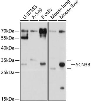 Western blot analysis of extracts of various cell lines, using Anti-SCN3B Antibody (A10316) at 1:1,000 dilution.
Secondary antibody: Goat Anti-Rabbit IgG (H+L) (HRP) (AS014) at 1:10,000 dilution.
Lysates / proteins: 25µg per lane.
Blocking buffer: 3% non-fat dry milk in TBST.
Detection: ECL Basic Kit (RM00020).
Exposure time: 5s.