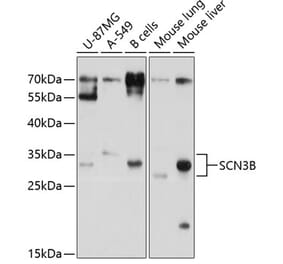 Western Blot - Anti-SCN3B Antibody (A11284) - Antibodies.com